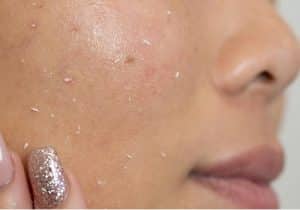 🥇Best Face Washes Cleansers for Blackheads 1 best face washes cleansers for blackheads