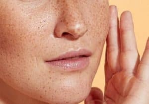 🥇Best Skin Lightening Creams for Hyperpigmentation – Gentle & Safe to Use 1 best skin lightening creams for hyperpigmentation