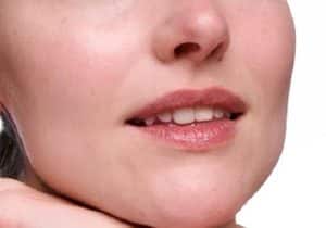 10 Best Sunscreens for Melasma 1 best sunscreens for melasma