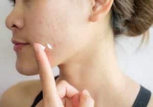 Don't Miss Out Acne Skin Care Tips 1 acne skin care tips